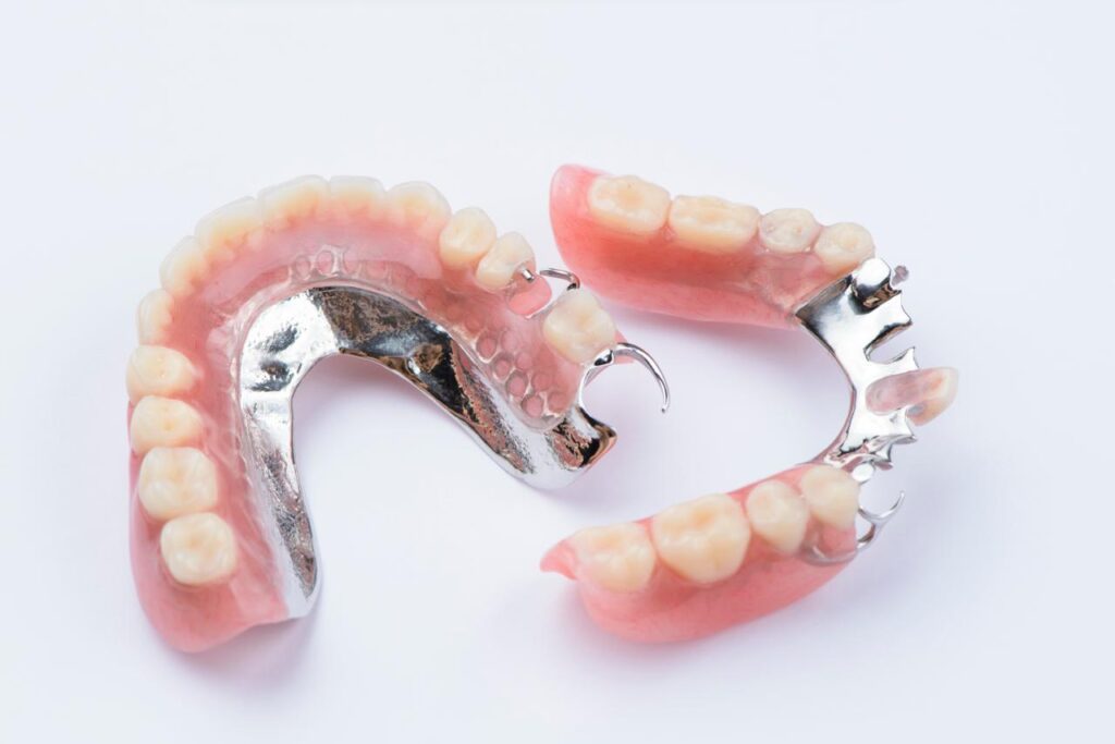 Metal-framed partial denture on a white background