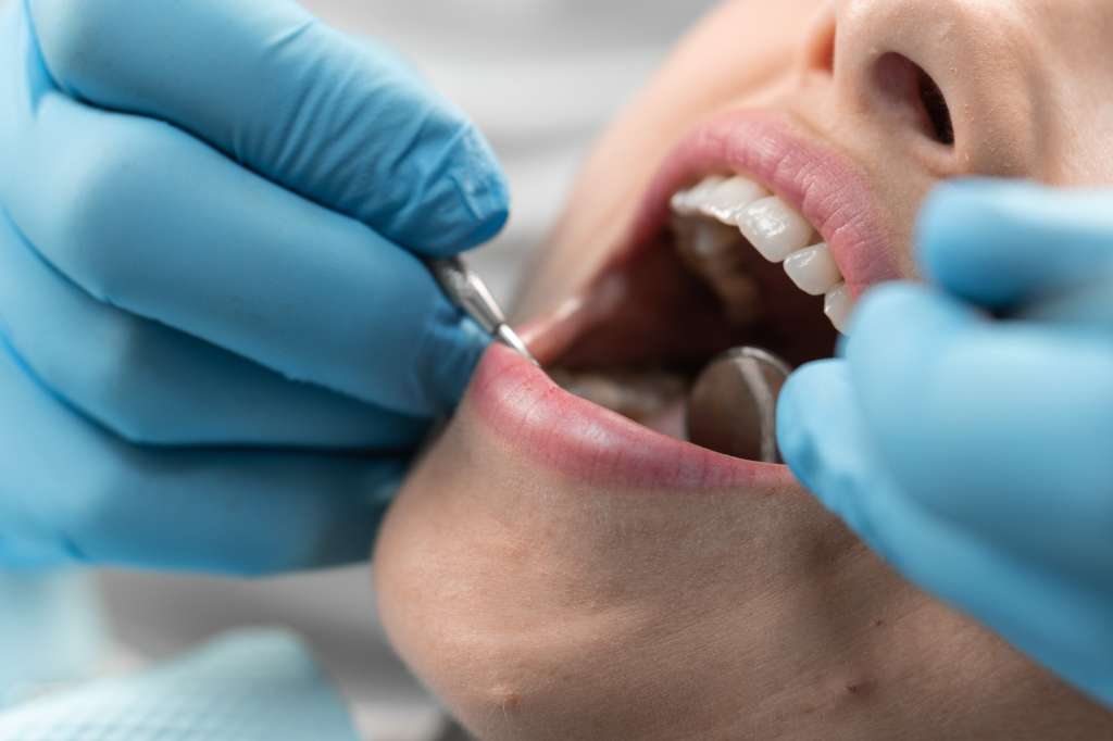 Hygienist cleaning a patient's teeth with a dental scaler